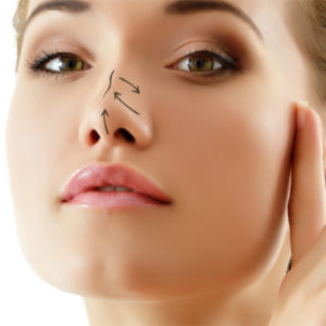 clinica de rinoplastia