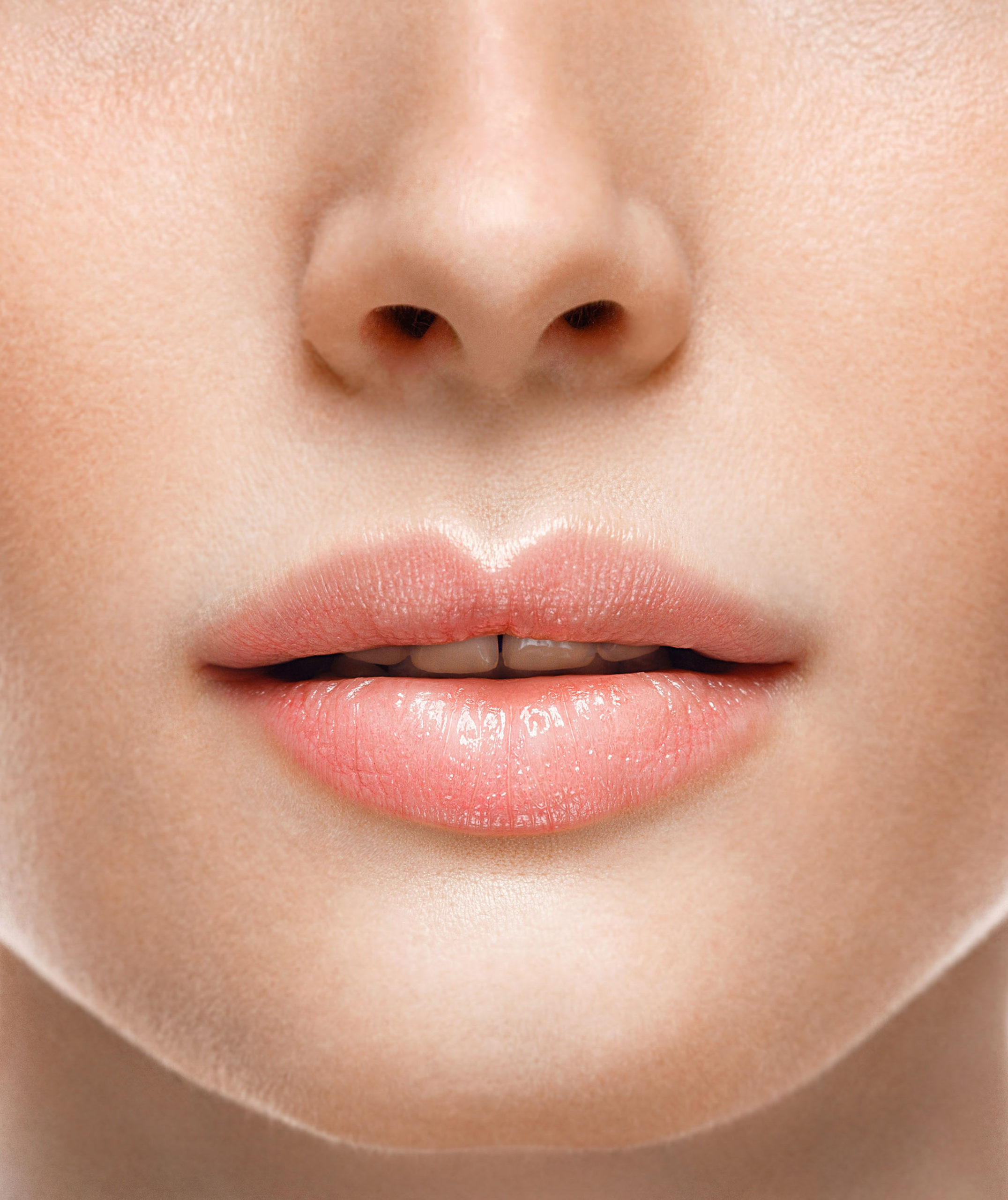 Complicaciones comunes en la rinoplastia y cómo prevenirlas